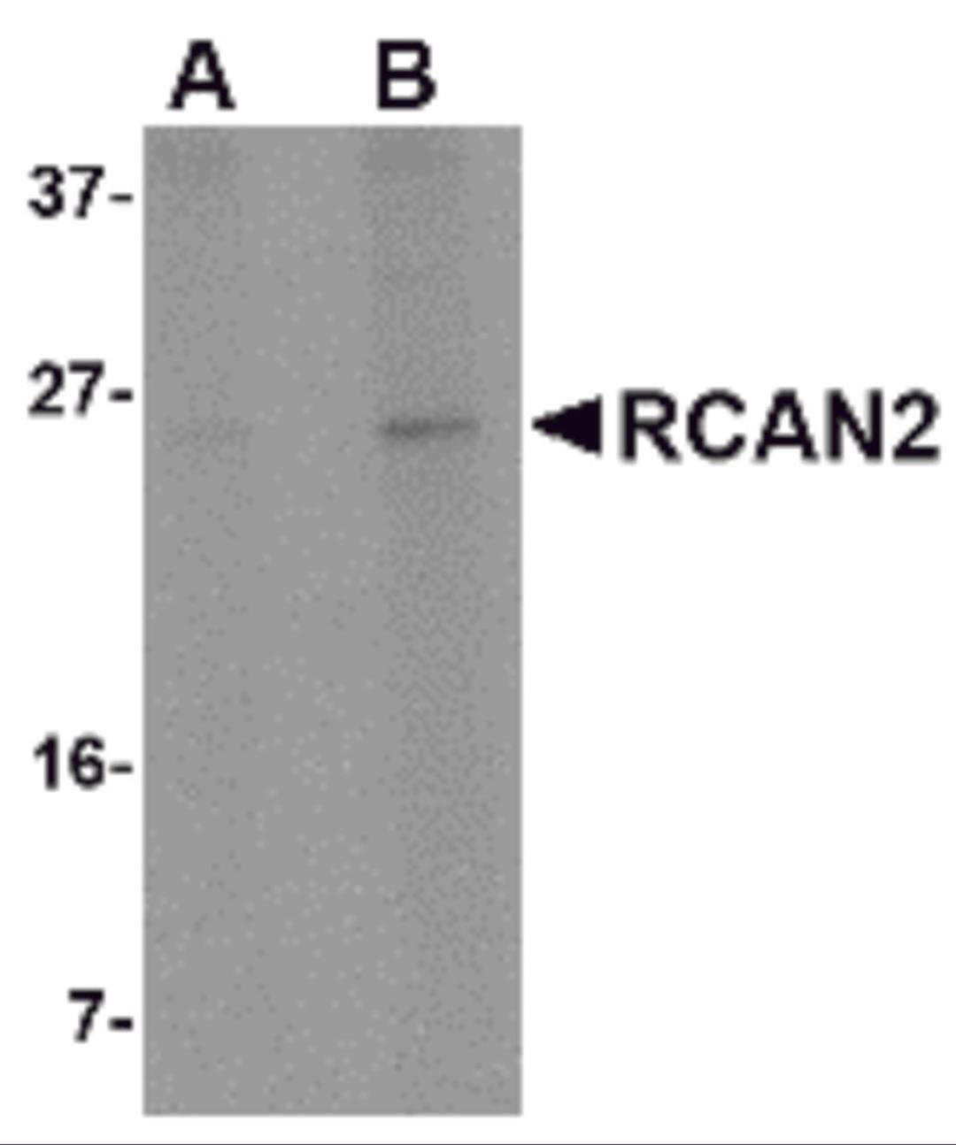Western blot analysis of RCAN2 in 3T3 cell lysate with RCAN2 antibody at (A) 1 and (B) 2 μg/mL.