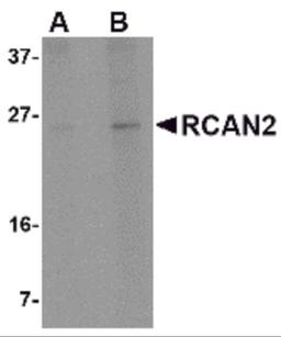 Western blot analysis of RCAN2 in 3T3 cell lysate with RCAN2 antibody at (A) 1 and (B) 2 μg/mL.