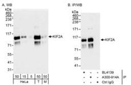 Detection of human and mouse KIF2A by western blot (h&m) and immunoprecipitation (h).