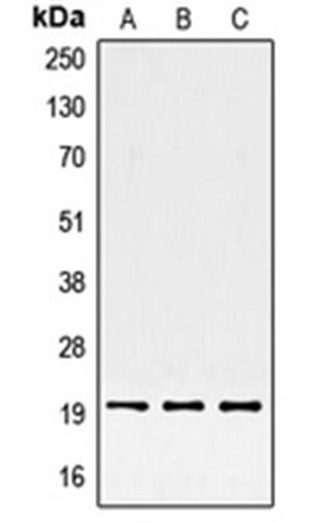 Western blot analysis of HepG2 (Lane 1), HeLa (Lane 2), BJAB (Lane 3) whole cell lysates using SRSF3 antibody