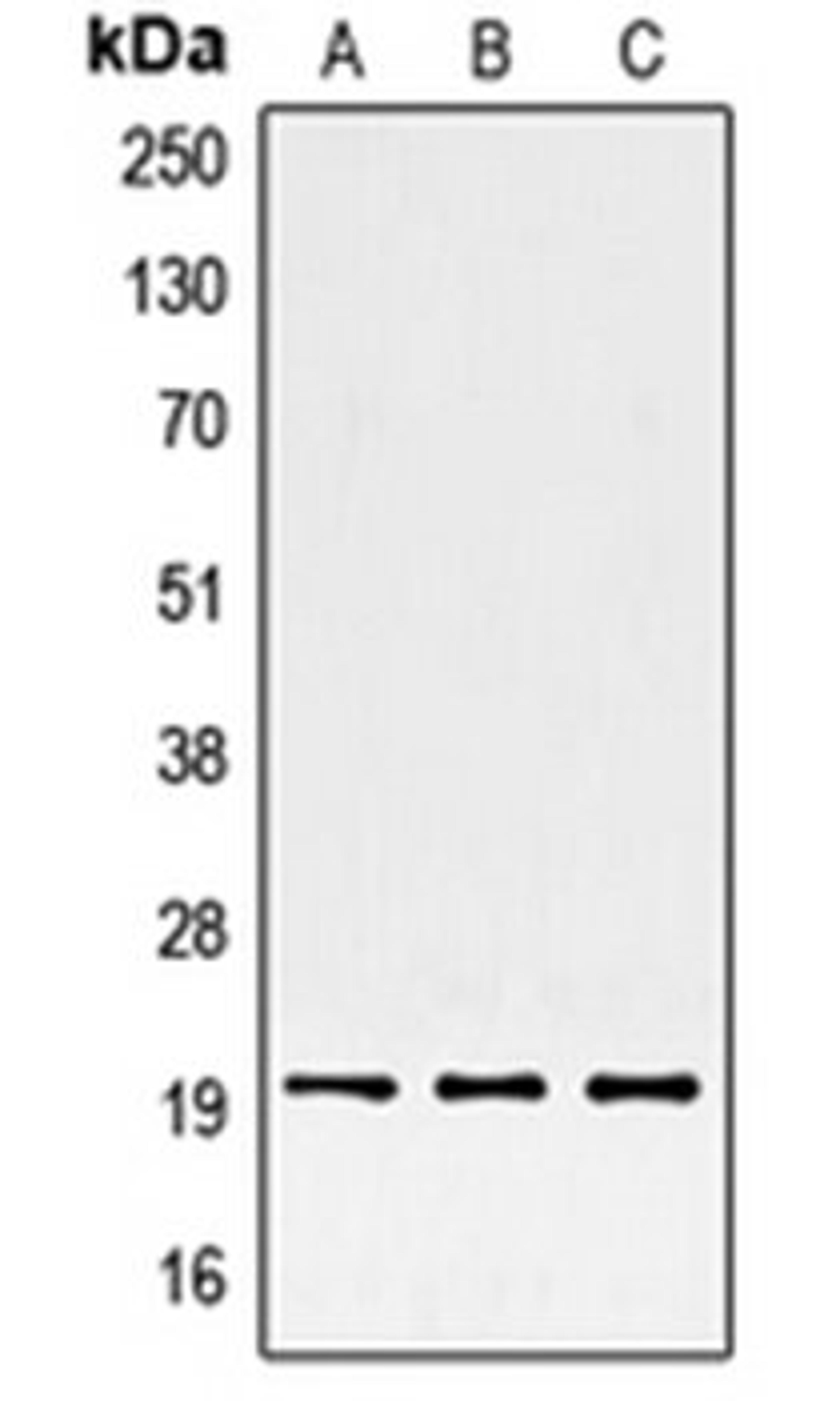 Western blot analysis of HepG2 (Lane 1), HeLa (Lane 2), BJAB (Lane 3) whole cell lysates using SRSF3 antibody