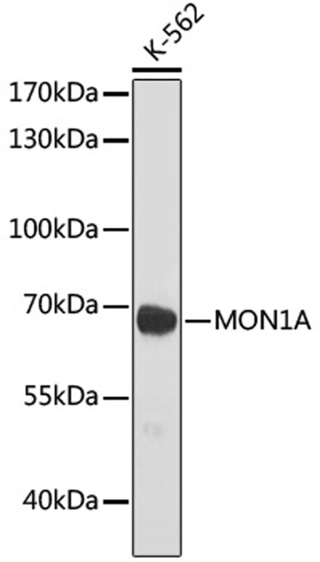 Western blot - MON1A antibody (A17946)