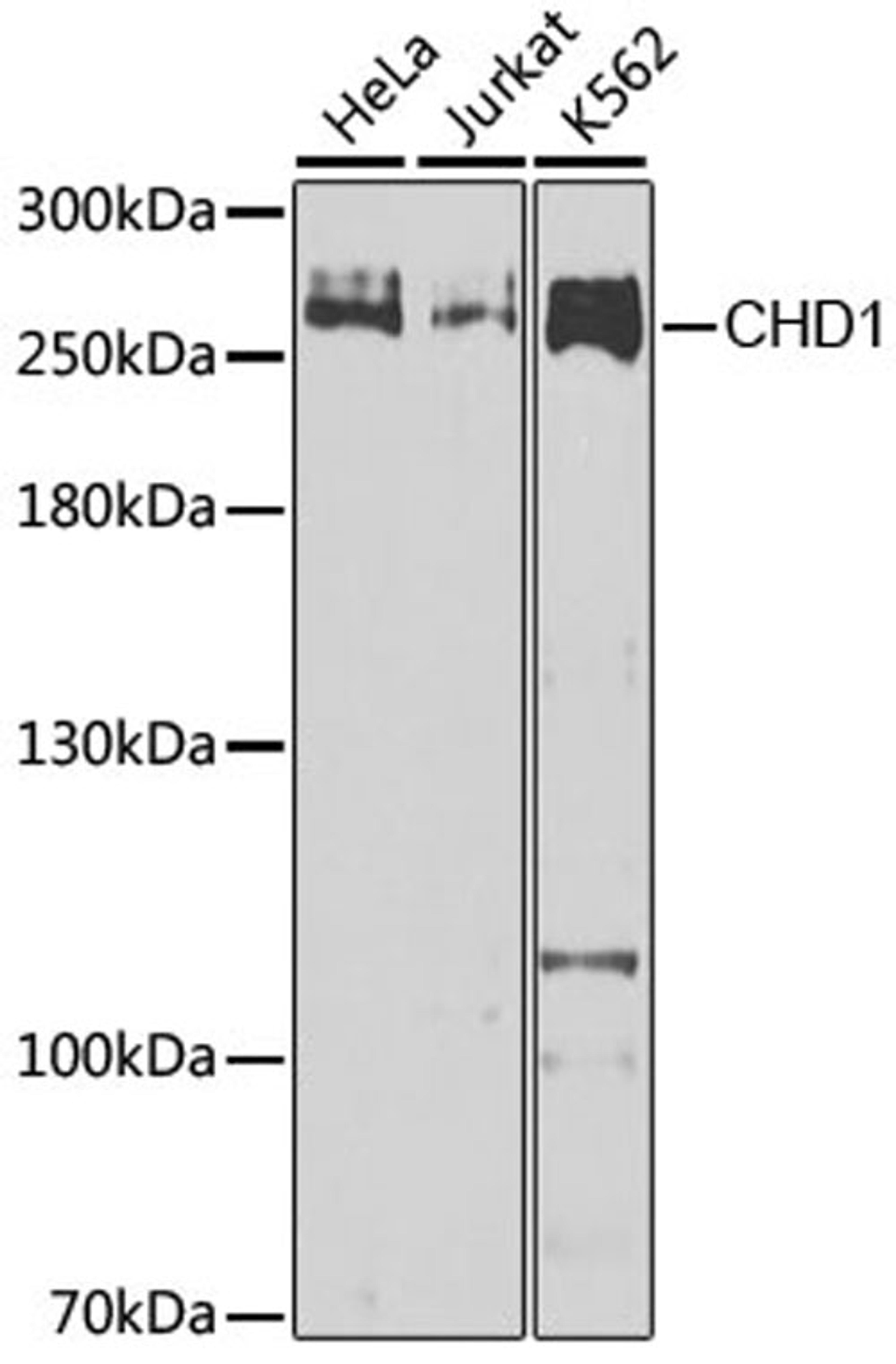 Western blot - CHD1 Antibody (A7883)