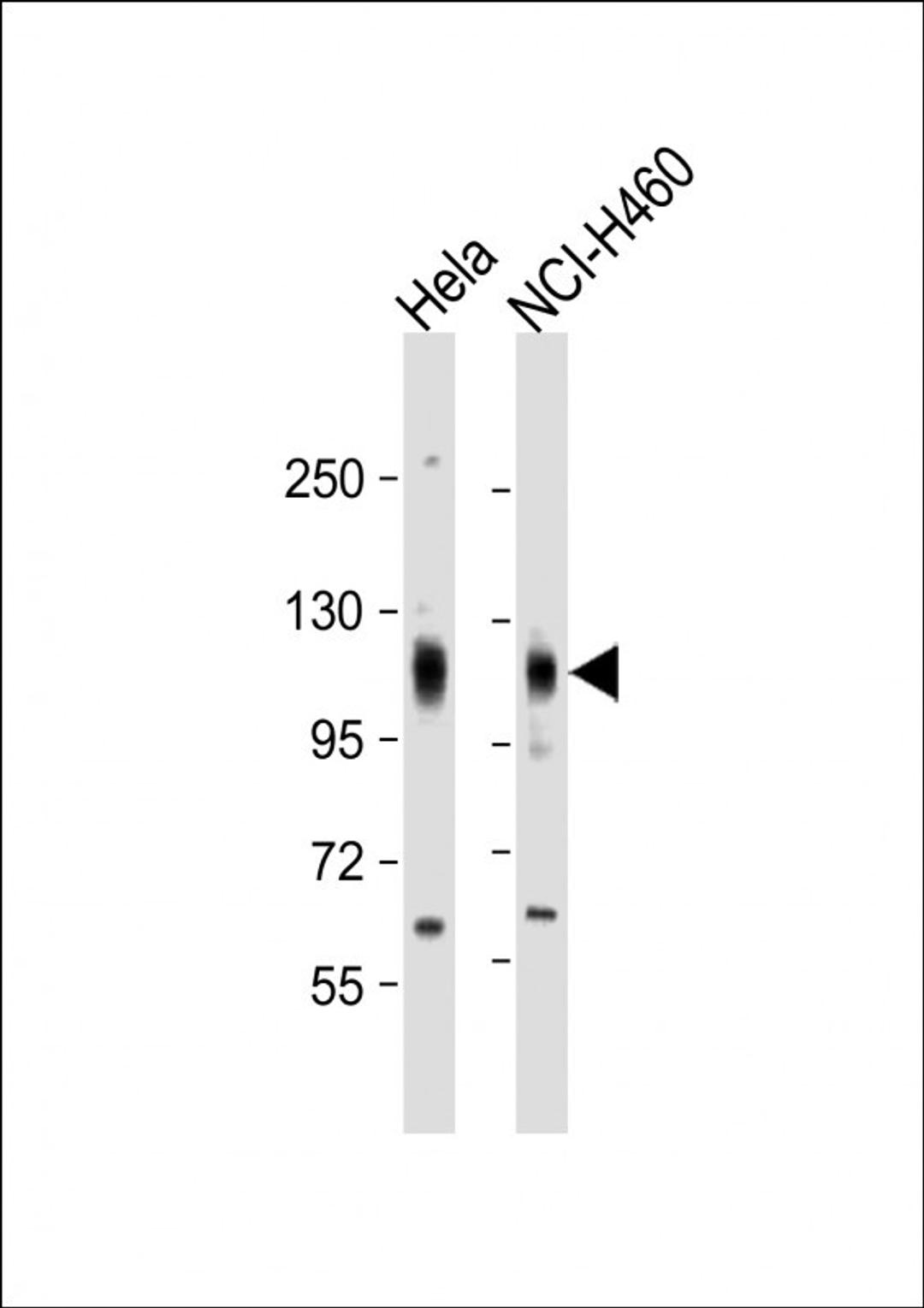 Western Blot at 1:2000 dilution Lane 1: Hela whole cell lysate Lane 2: NCI-H460 whole cell lysate Lysates/proteins at 20 ug per lane.