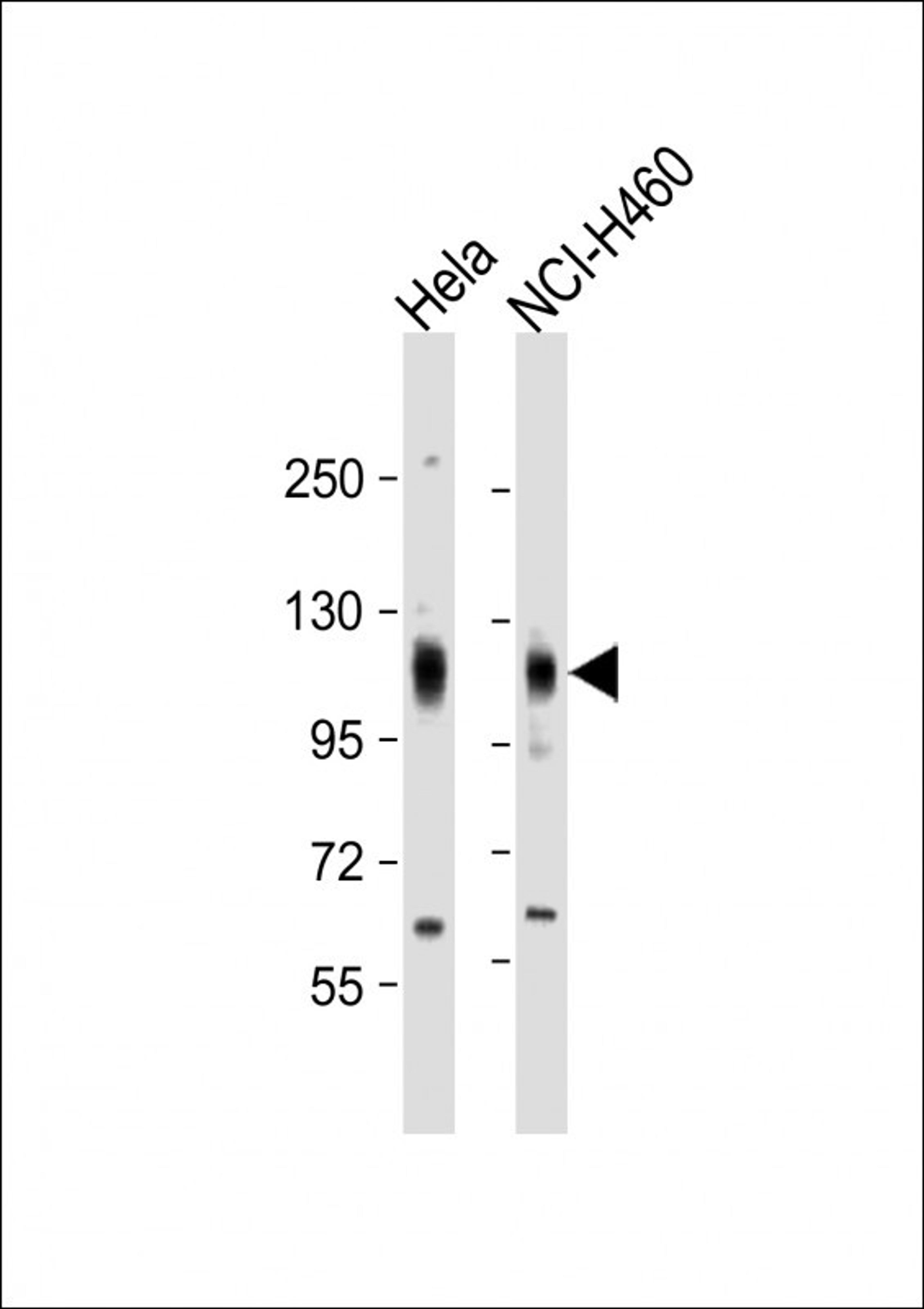 Western Blot at 1:2000 dilution Lane 1: Hela whole cell lysate Lane 2: NCI-H460 whole cell lysate Lysates/proteins at 20 ug per lane.