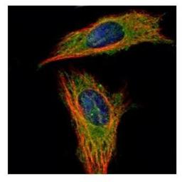 Immunocytochemistry/Immunofluorescence: RABGAP1 Antibody [NBP2-15086] - Analysis of methanol-fixed HeLa, using RABGAP1 antibody (Green) at 1:500 dilution. Alpha-tubulin filaments were labeled with an alpha Tubulin antibody (Red) at 1:2000.