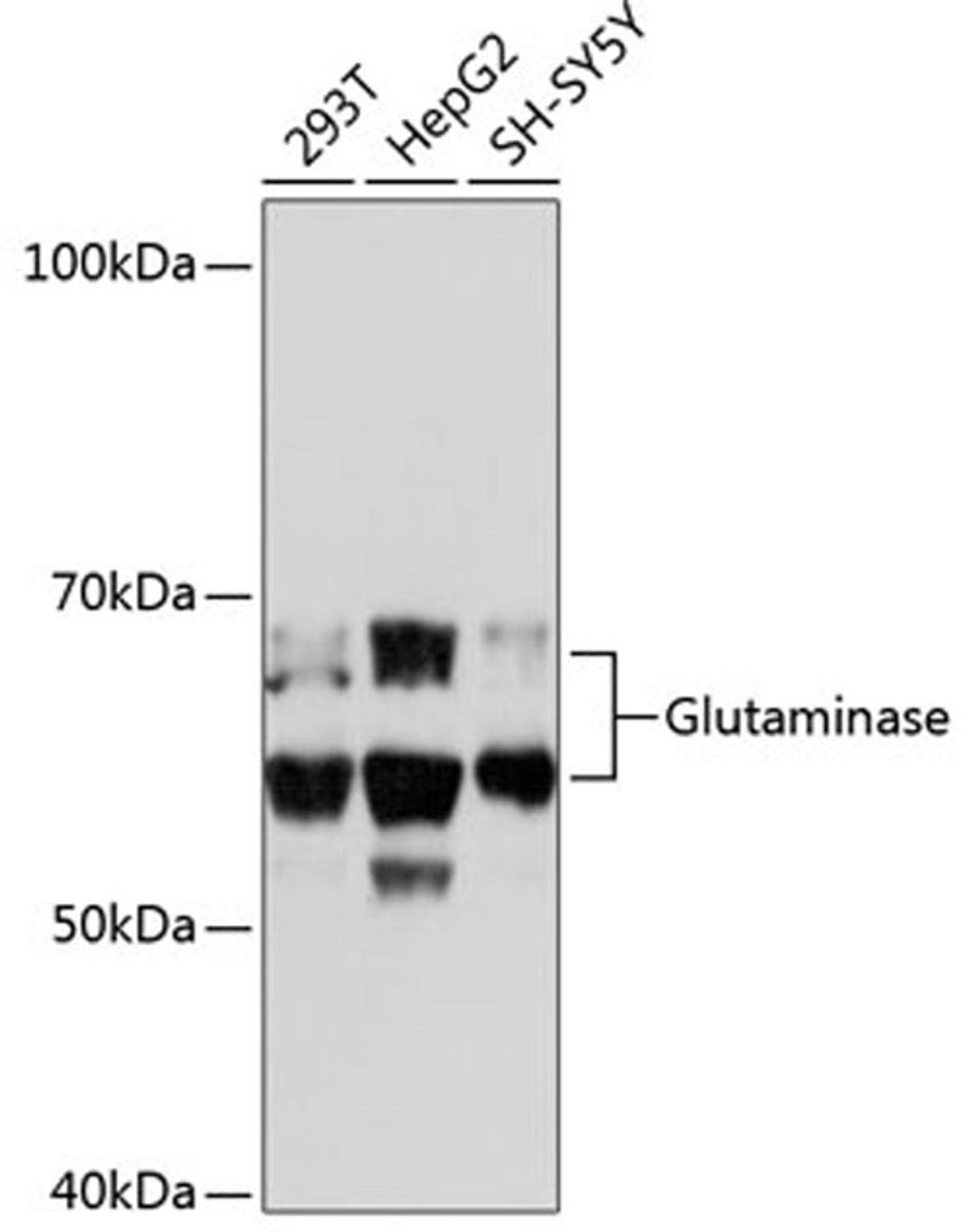 Western blot -  Glutaminase Rabbit mAb (A11043)