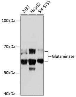 Western blot - Glutaminase Rabbit mAb (A11043)