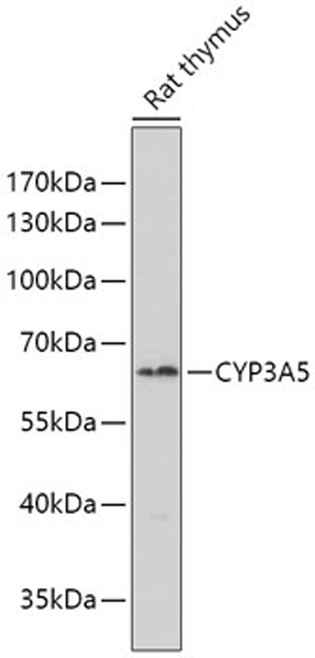 Western blot - CYP3A5 antibody (A7663)