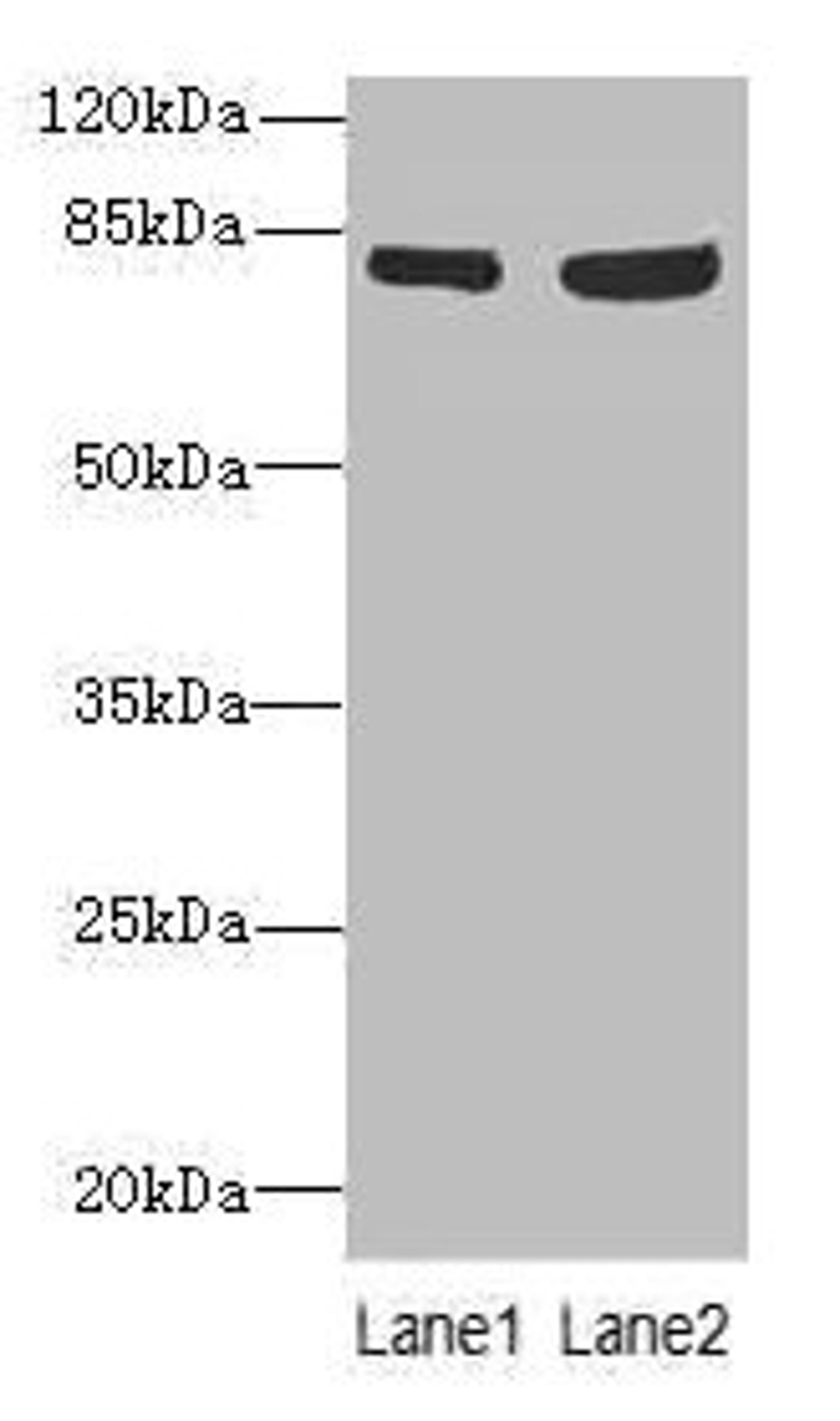 Western blot. All lanes: TARS antibody at 4.85µg/ml. Lane 1: A549 whole cell lysate. Lane 2: Hela whole cell lysate. Secondary. Goat polyclonal to rabbit IgG at 1/10000 dilution. Predicted band size: 84, 87 kDa. Observed band size: 84 kDa