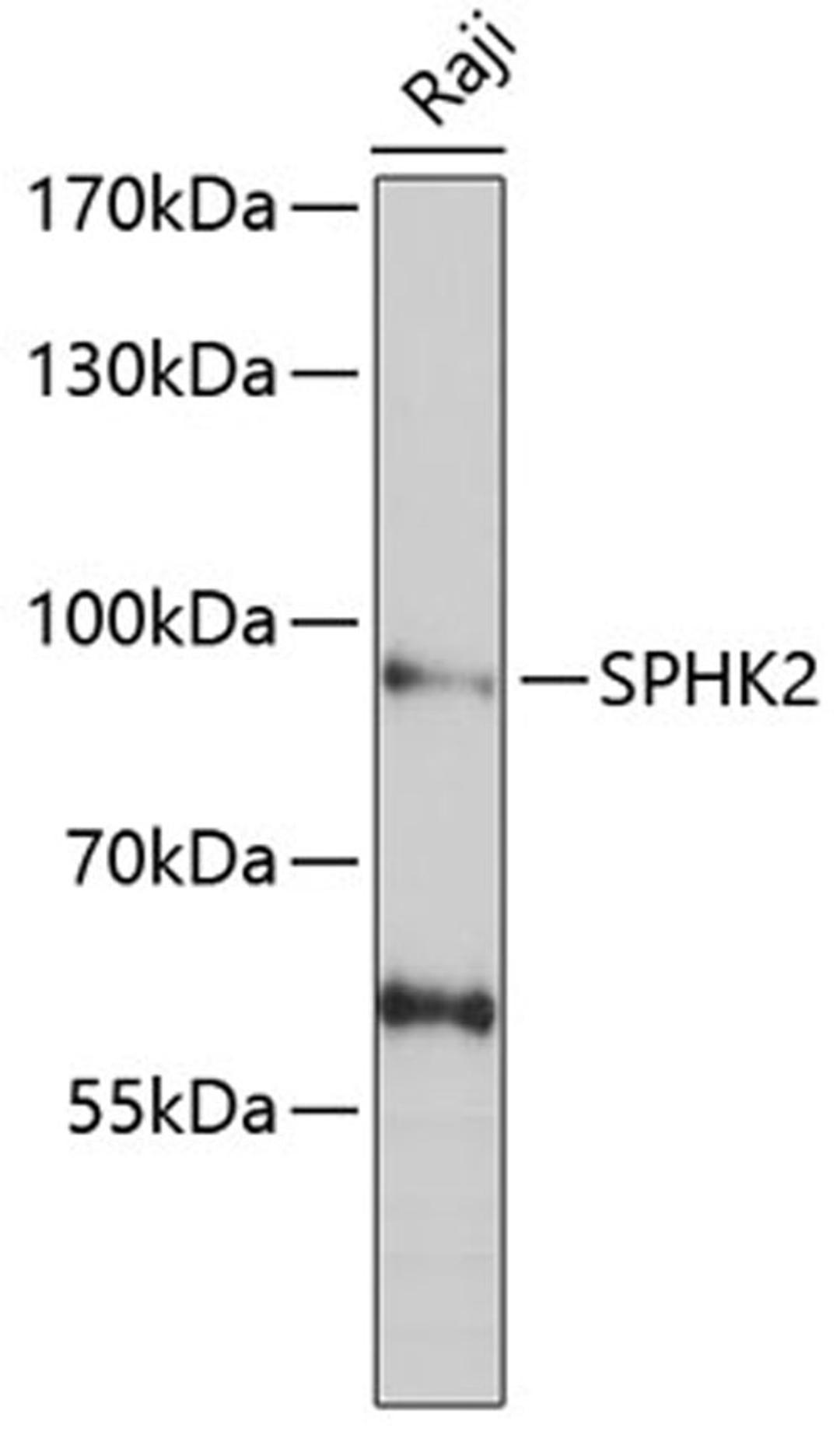 Western blot - SPHK2 antibody (A6748)