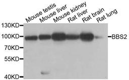 Western blot analysis of extracts of various cell lines using BBS2 antibody