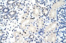 Antibody used in IHC on Human kidney.