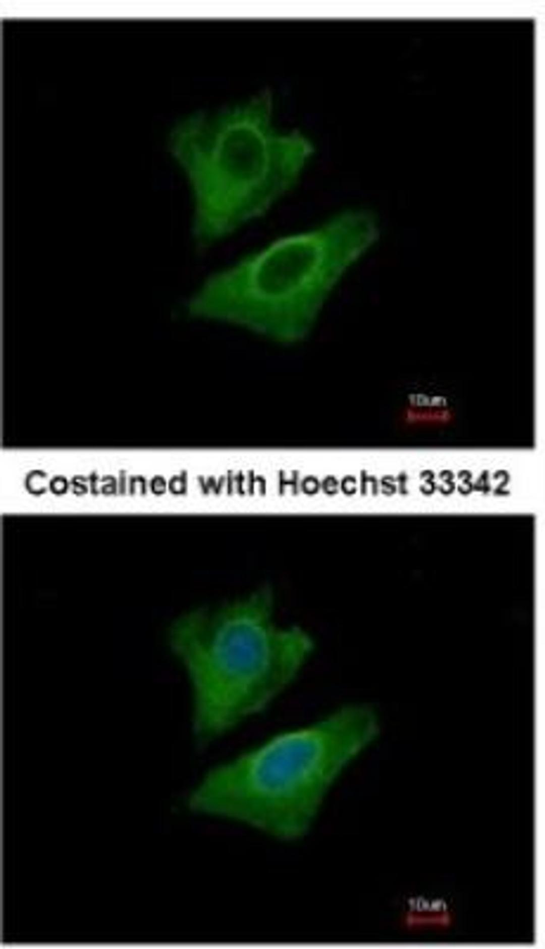 Immunocytochemistry: ALDH1A3 Antibody [NBP2-15339] - Analysis of methanol-fixed A549, using antibody at 1:500 dilution.