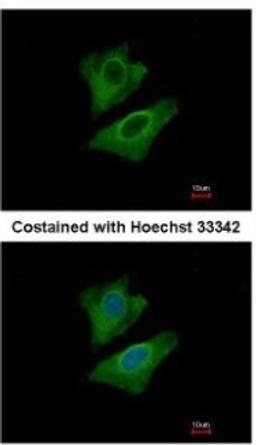 Immunocytochemistry: ALDH1A3 Antibody [NBP2-15339] - Analysis of methanol-fixed A549, using antibody at 1:500 dilution.