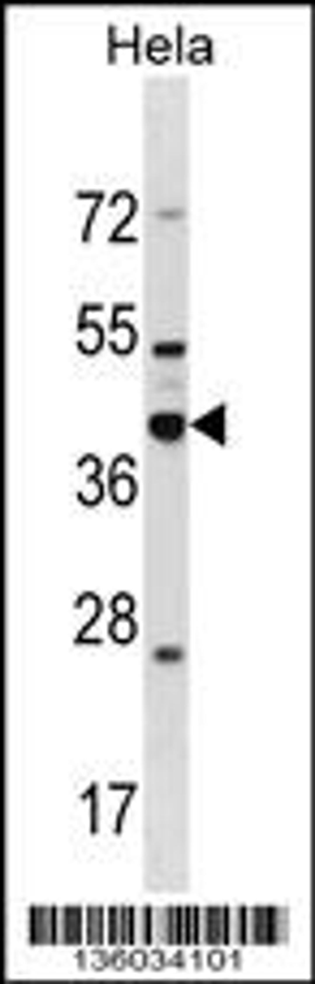 Western blot analysis in Hela cell line lysates (35ug/lane).