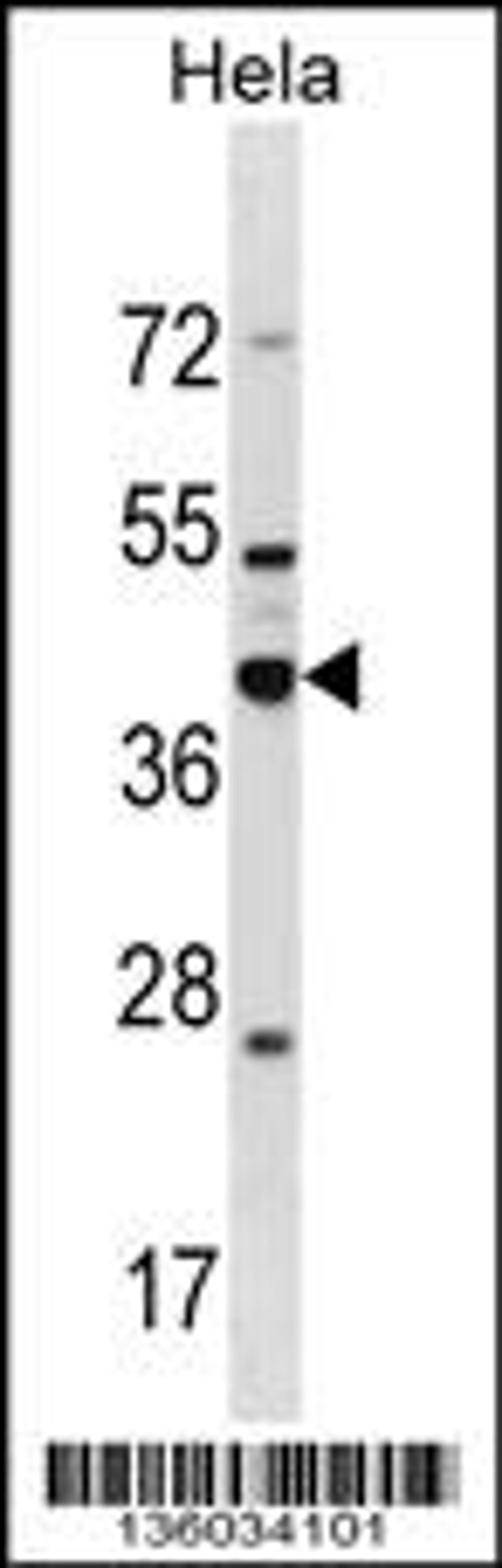 Western blot analysis in Hela cell line lysates (35ug/lane).