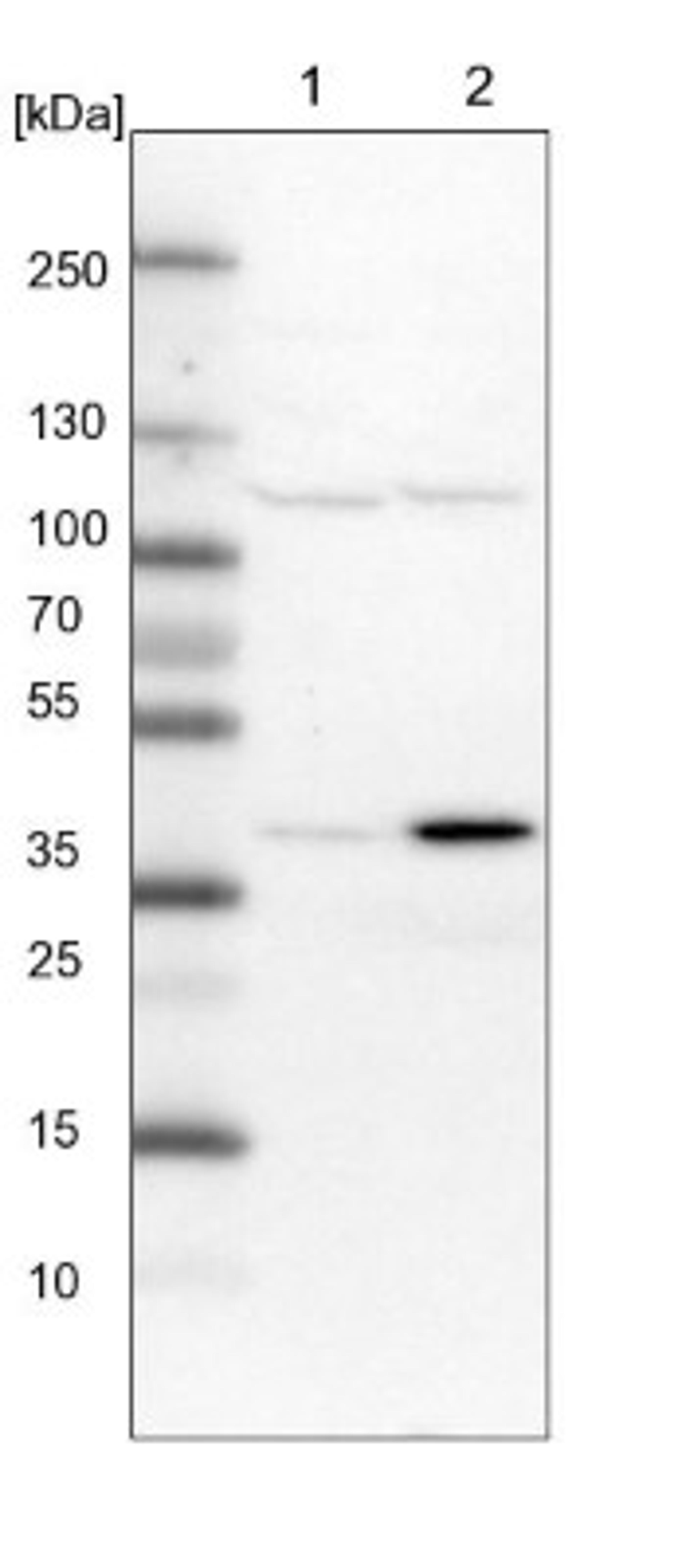 Western Blot: SNX16 Antibody [NBP1-85975] - Lane 1: NIH-3T3 cell lysate (Mouse embryonic fibroblast cells)<br/>Lane 2: NBT-II cell lysate (Rat Wistar bladder tumour cells)