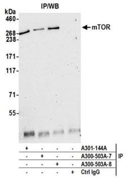 Detection of human mTOR by western blot of immunoprecipitates.