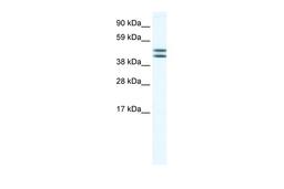 Antibody used in WB on Human Placenta at 0.2-1 ug/ml.