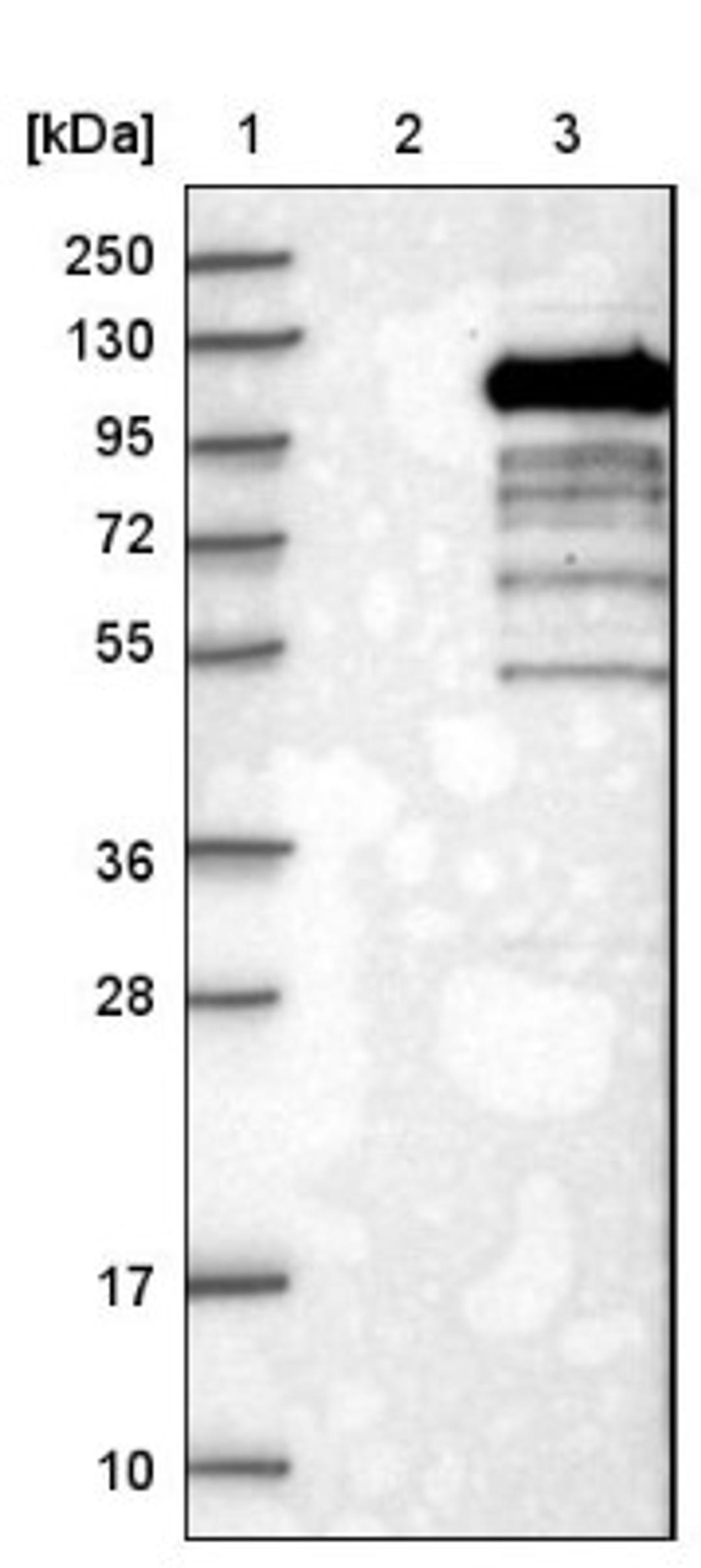 Western Blot: MASTL Antibody [NBP1-83680] - Lane 1: Marker [kDa] 250, 130, 95, 72, 55, 36, 28, 17, 10<br/>Lane 2: Negative control (vector only transfected HEK293T lysate)<br/>Lane 3: Over-expression lysate (Co-expressed with a C-terminal myc-DDK tag (~3.1 kDa) in mammalian HEK293T cells, LY403204)