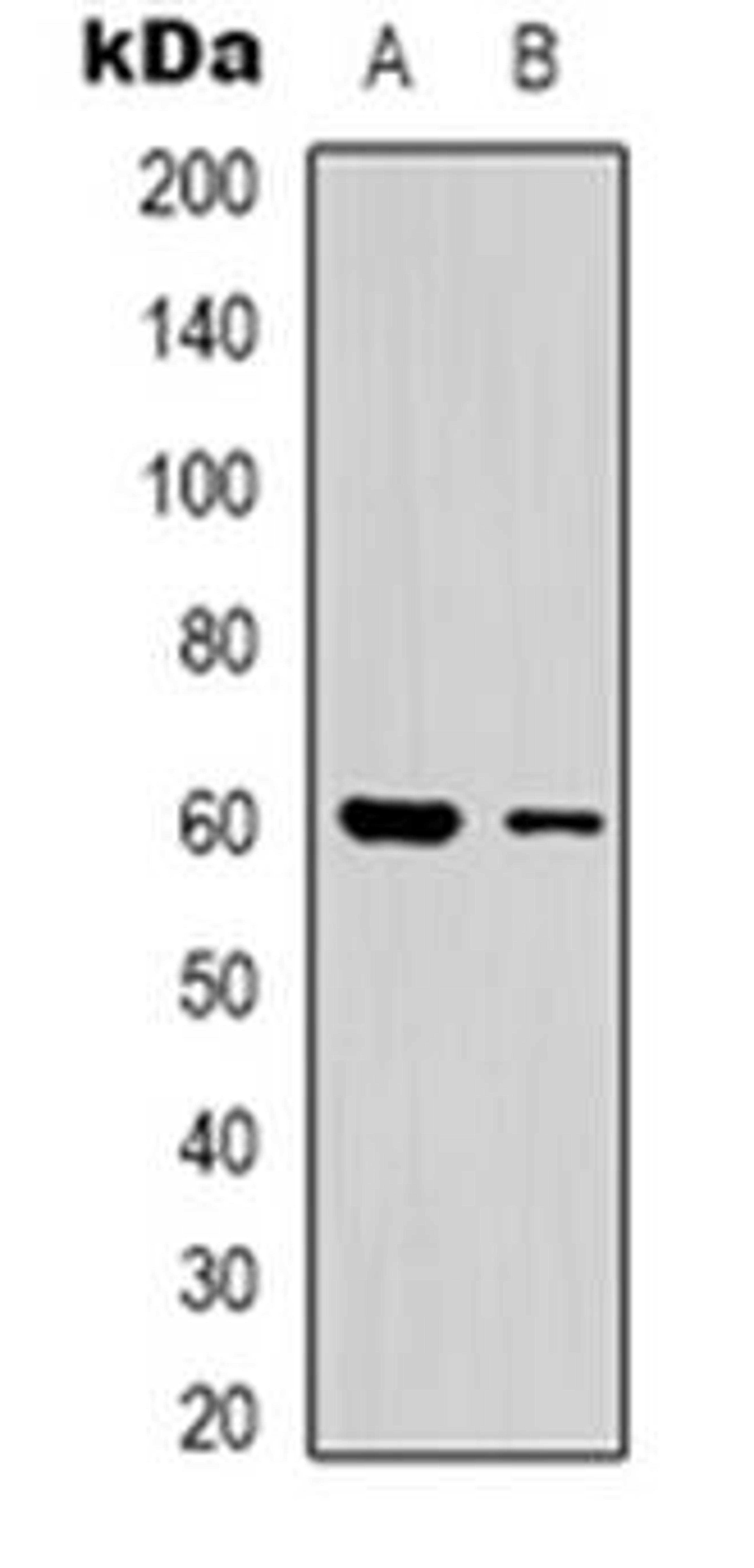 Western blot analysis of CLIP3 expression in human brain (Lane 1), A549 (Lane 2) whole cell lysates using CLIP3 antibody