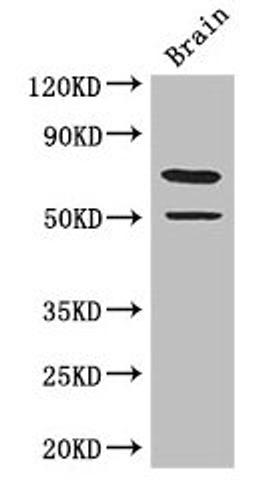 Western Blot. Positive WB detected in: Mouse brain tissue. All lanes: GRAMD4 antibody at 3.4µg/ml. Secondary. Goat polyclonal to rabbit IgG at 1/50000 dilution. Predicted band size: 67, 11 kDa. Observed band size: 67 kDa