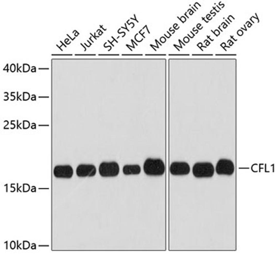 Western blot - CFL1 antibody (A1704)