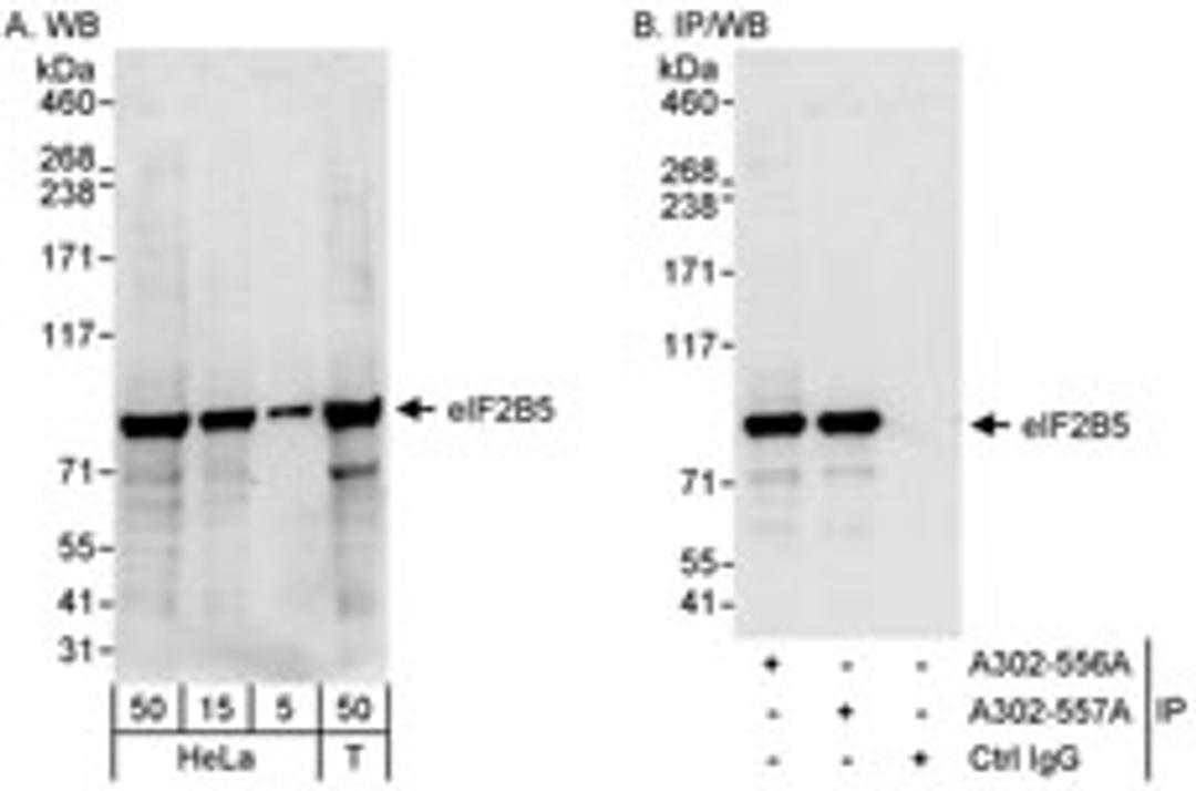 Detection of human eIF2B5 by western blot and immunoprecipitation.