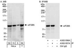 Detection of human eIF2B5 by western blot and immunoprecipitation.