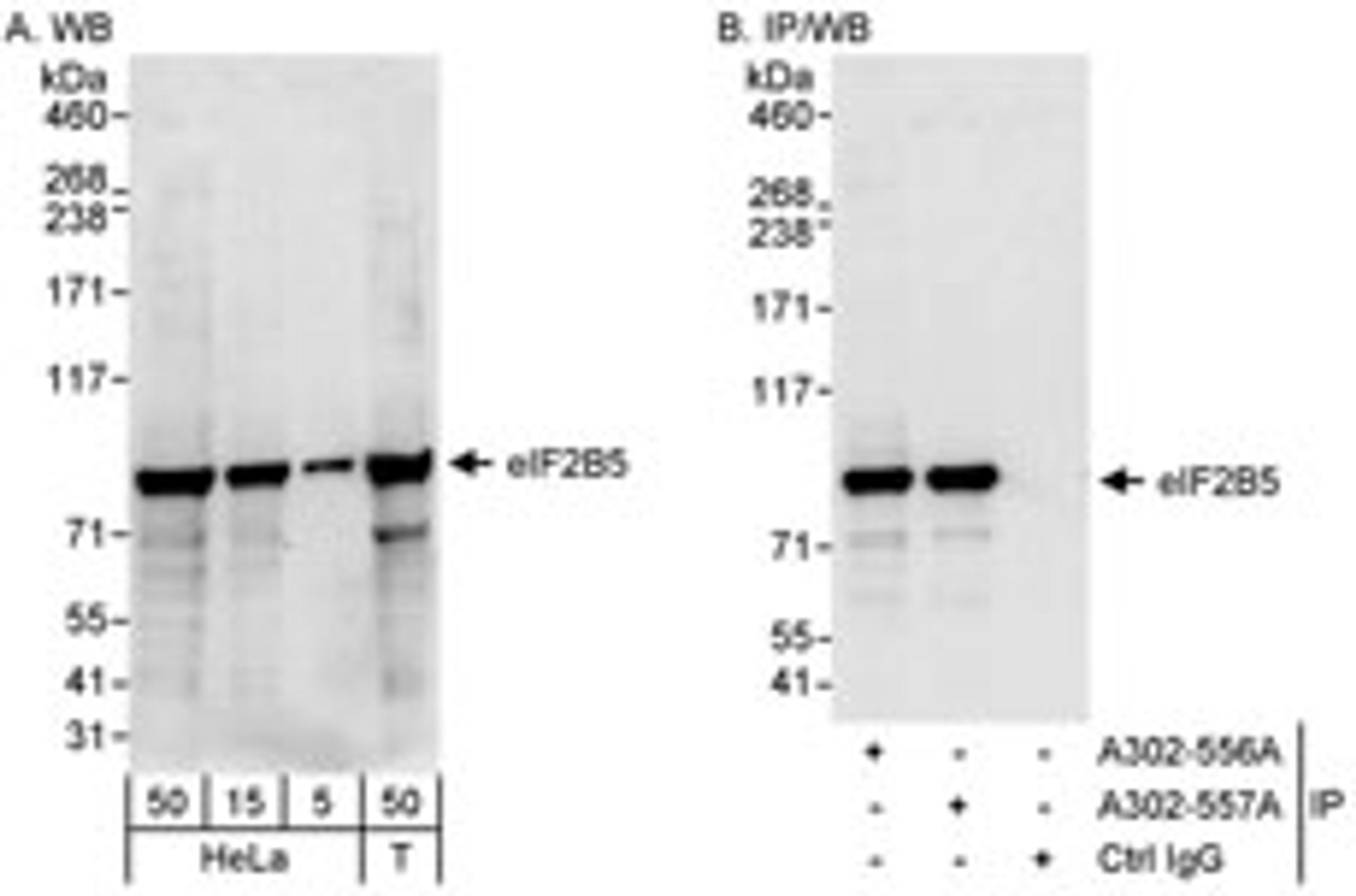 Detection of human eIF2B5 by western blot and immunoprecipitation.