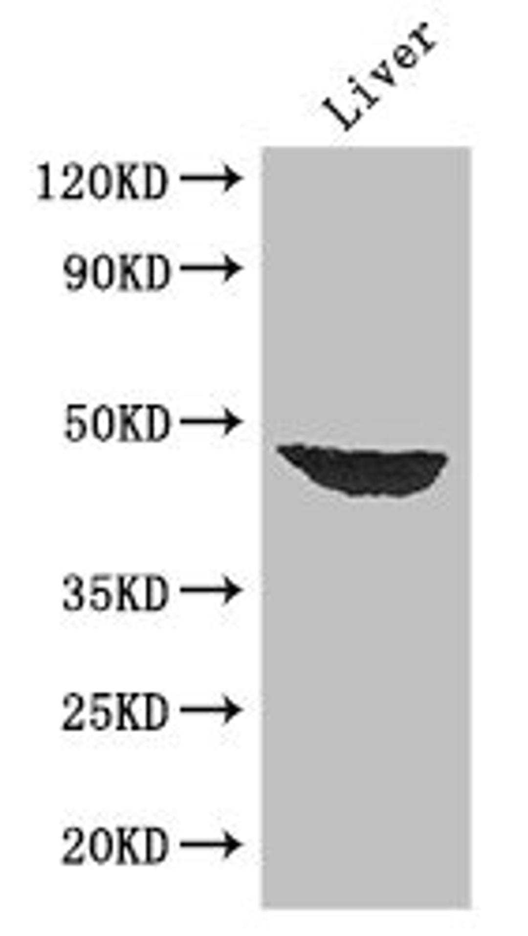 Western Blot. Positive WB detected in: Mouse liver tissue. All lanes: AFF4 antibody at 2.7ug/ml. Secondary. Goat polyclonal to rabbit IgG at 1/50000 dilution. Predicted band size: 127, 98, 39 kDa. Observed band size: 39 kDa. 