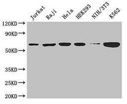 Western Blot. Positive WB detected in: Jurkat whole cell lysate, Raji whole cell lysate, Hela whole cell lysate, HEK293 whole cell lysate, NIH/3T3 whole cell lysate, K562 whole cell lysate. All lanes: CCT8 antibody at 3µg/ml. Secondary. Goat polyclonal to rabbit IgG at 1/50000 dilution. Predicted band size: 60, 58, 52 kDa. Observed band size: 60 kDa