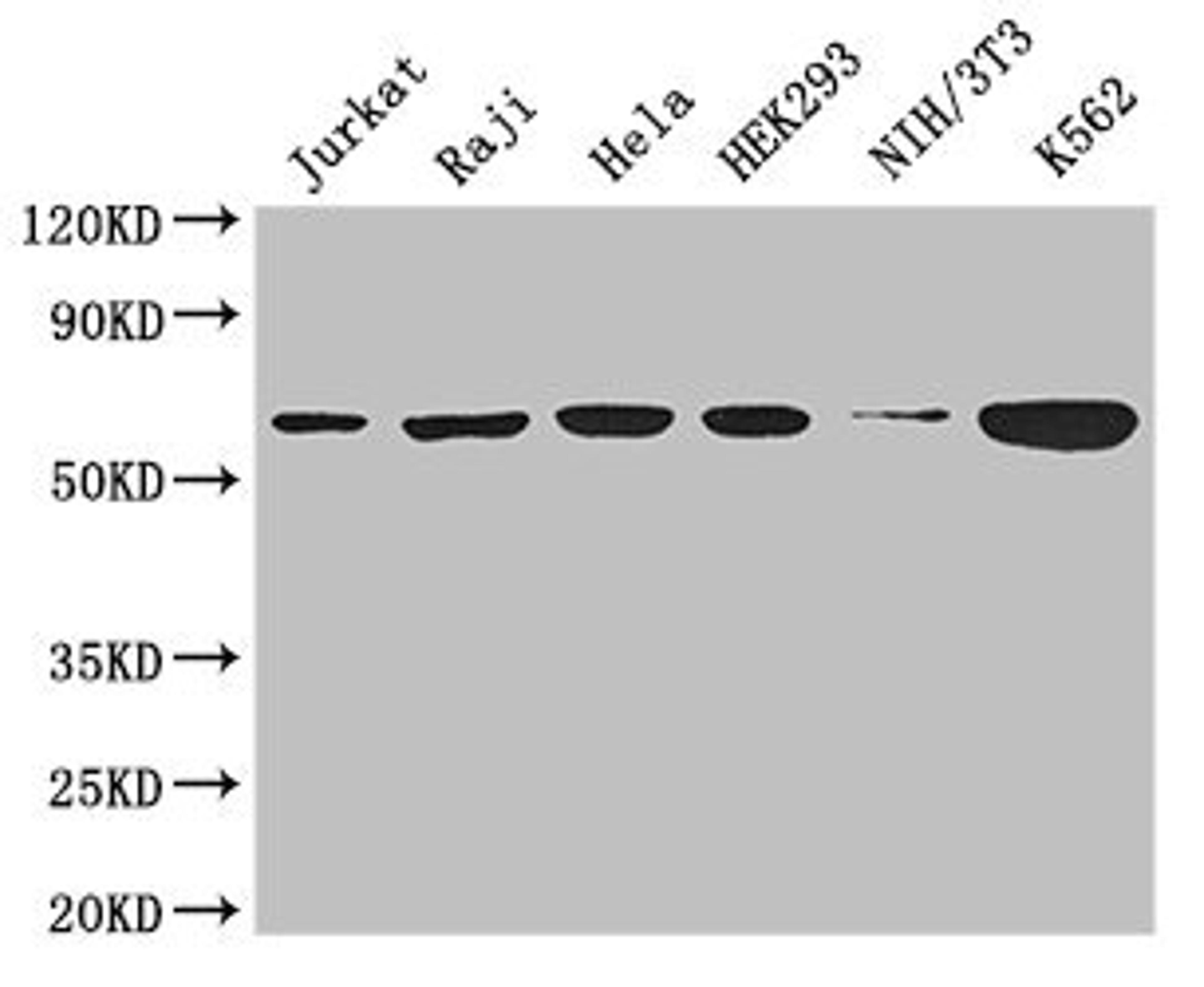 Western Blot. Positive WB detected in: Jurkat whole cell lysate, Raji whole cell lysate, Hela whole cell lysate, HEK293 whole cell lysate, NIH/3T3 whole cell lysate, K562 whole cell lysate. All lanes: CCT8 antibody at 3µg/ml. Secondary. Goat polyclonal to rabbit IgG at 1/50000 dilution. Predicted band size: 60, 58, 52 kDa. Observed band size: 60 kDa