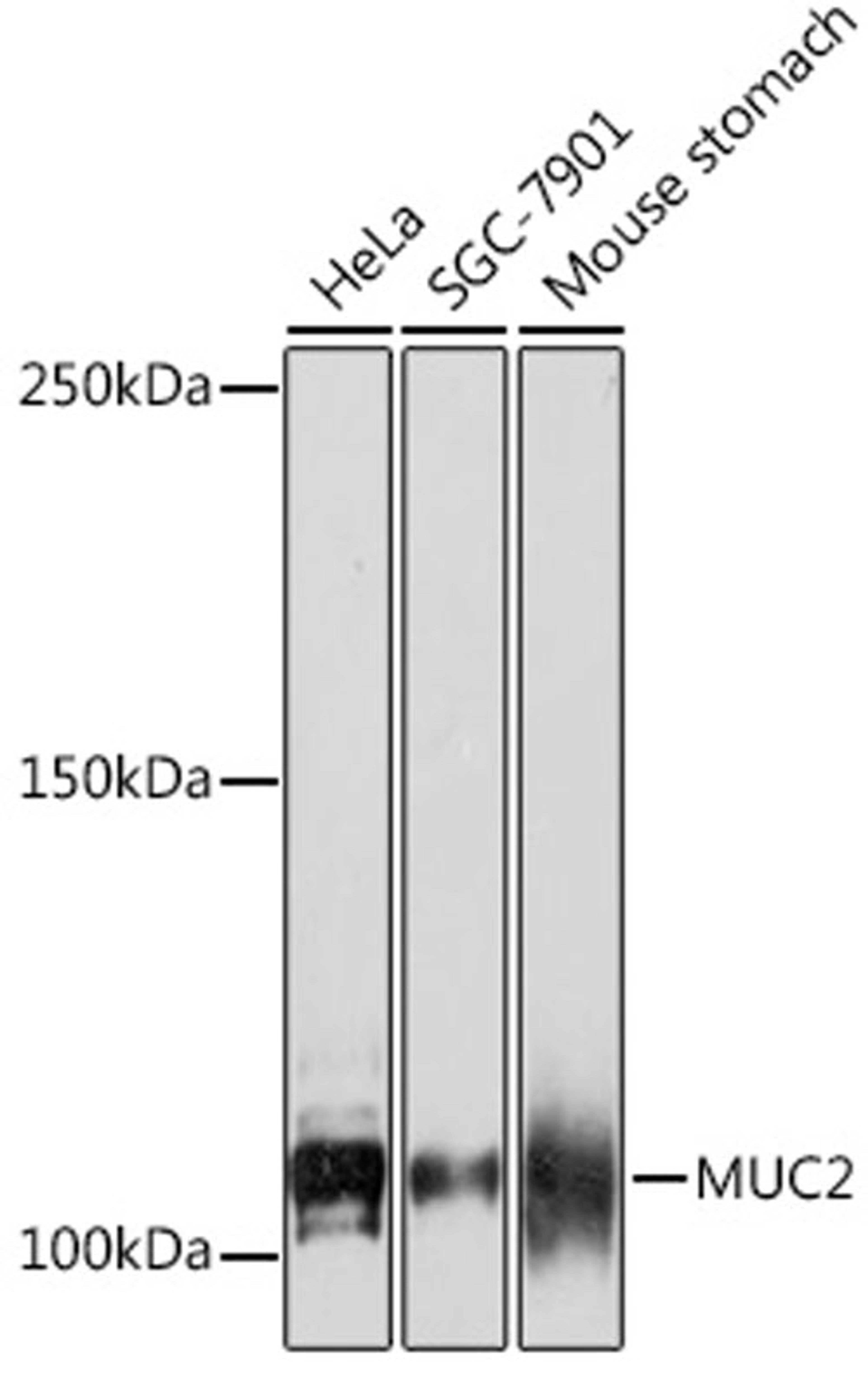 Western blot - MUC2 Rabbit mAb (A4767)