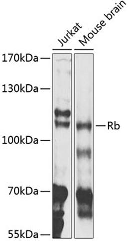 Western blot - Rb antibody (A11409)