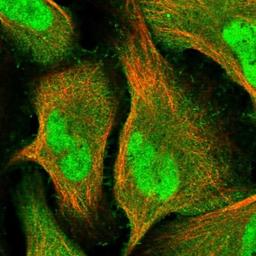 Immunocytochemistry/Immunofluorescence: LRRC17 Antibody [NBP1-83309] - Staining of human cell line U-2 OS shows positivity in nucleus but not nucleoli & plasma membrane.