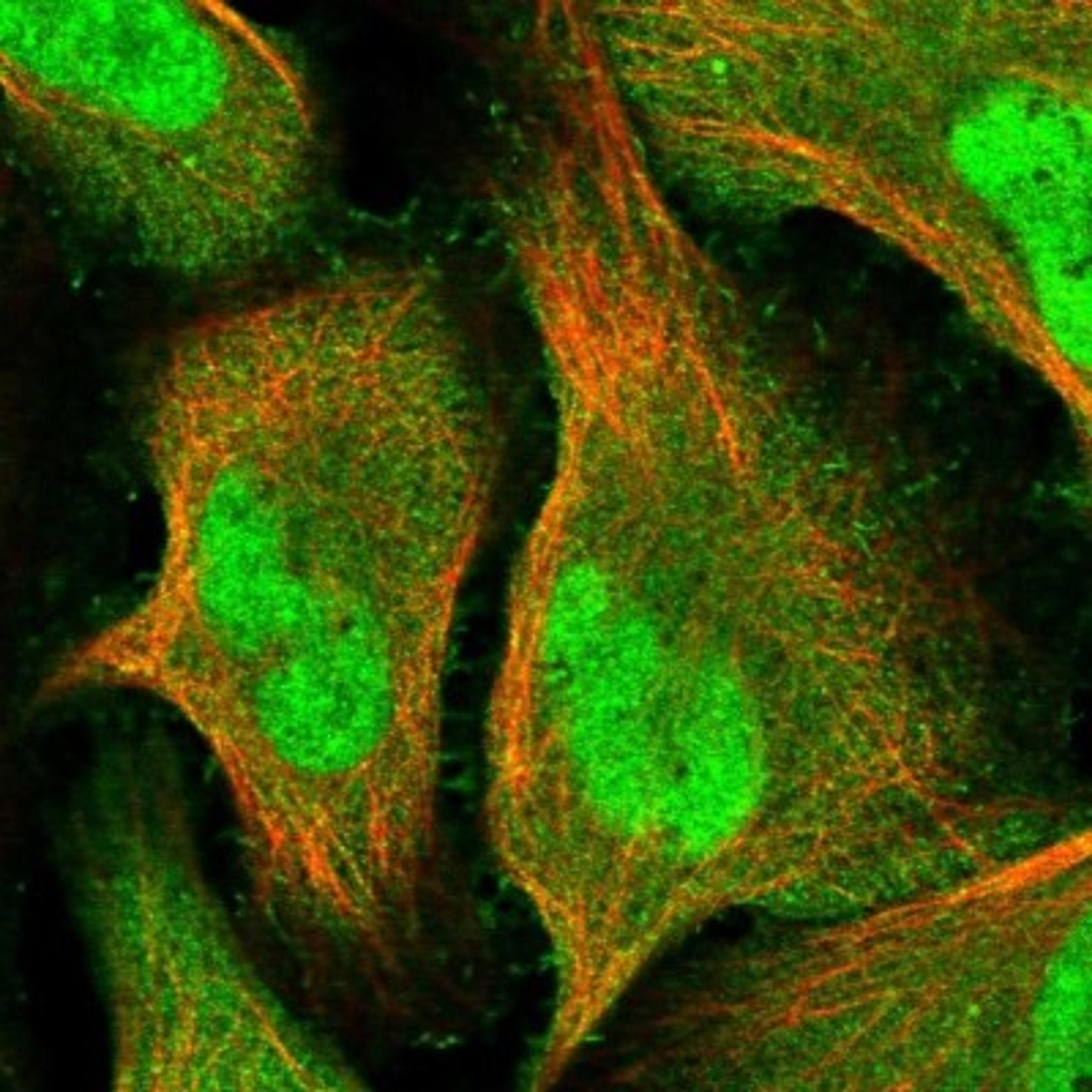 Immunocytochemistry/Immunofluorescence: LRRC17 Antibody [NBP1-83309] - Staining of human cell line U-2 OS shows positivity in nucleus but not nucleoli & plasma membrane.