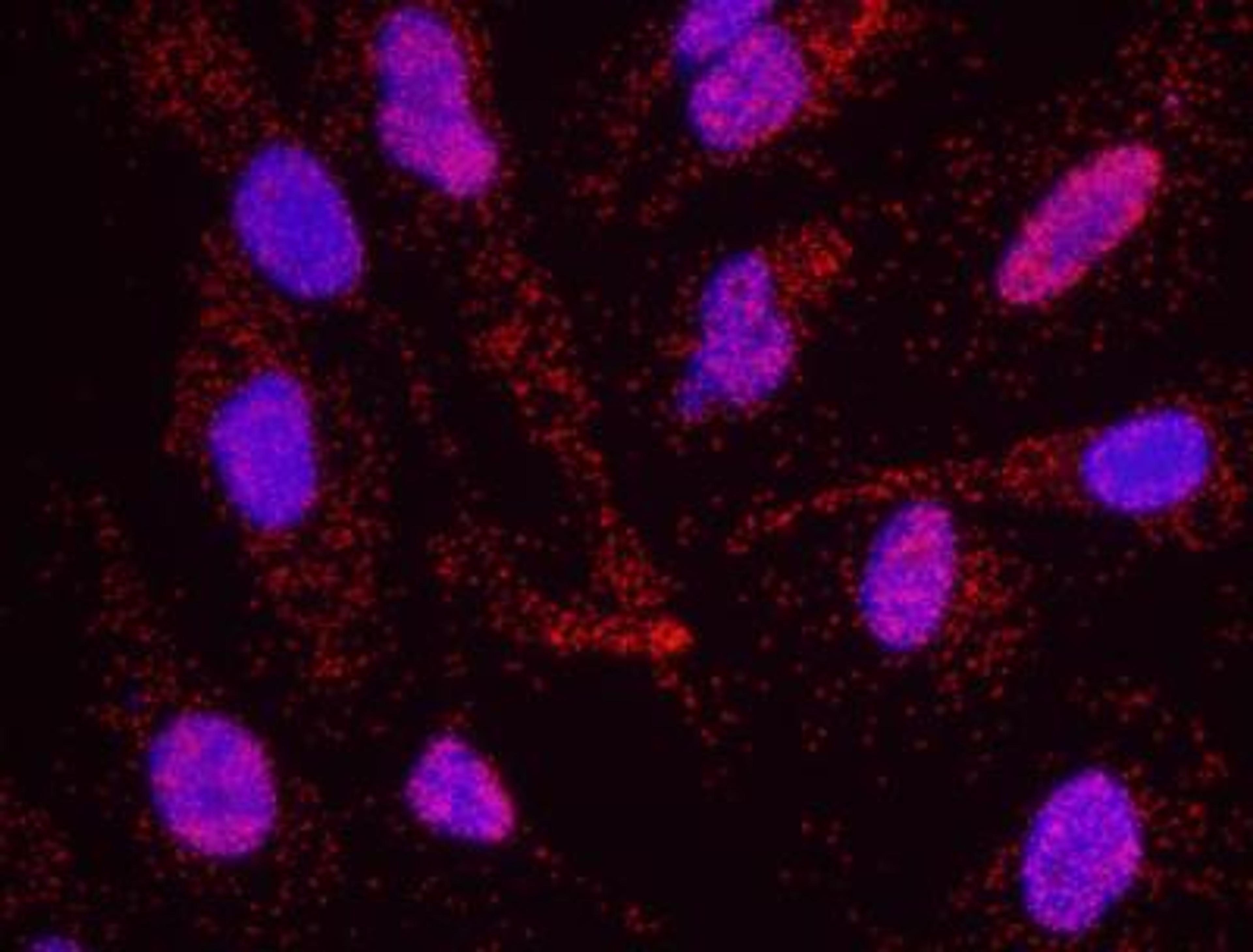 Proximity Ligation Assay: KAP1 [p Ser824] Antibody [NB100-2350] - Secondary-conjugate Duolink II PLA in Hela cells. goat anti-human ATM (NB100-271) and rabbit anti-human phospho-KAP1 [S824] (NB100-2350). Image merged from DAPI (2ms) and Texas Red (200ms) exposures, 40X magnification.