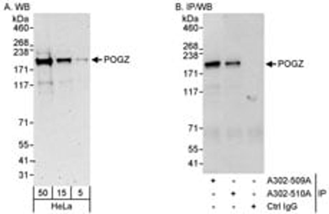 Detection of human POGZ by western blot and immunoprecipitation.