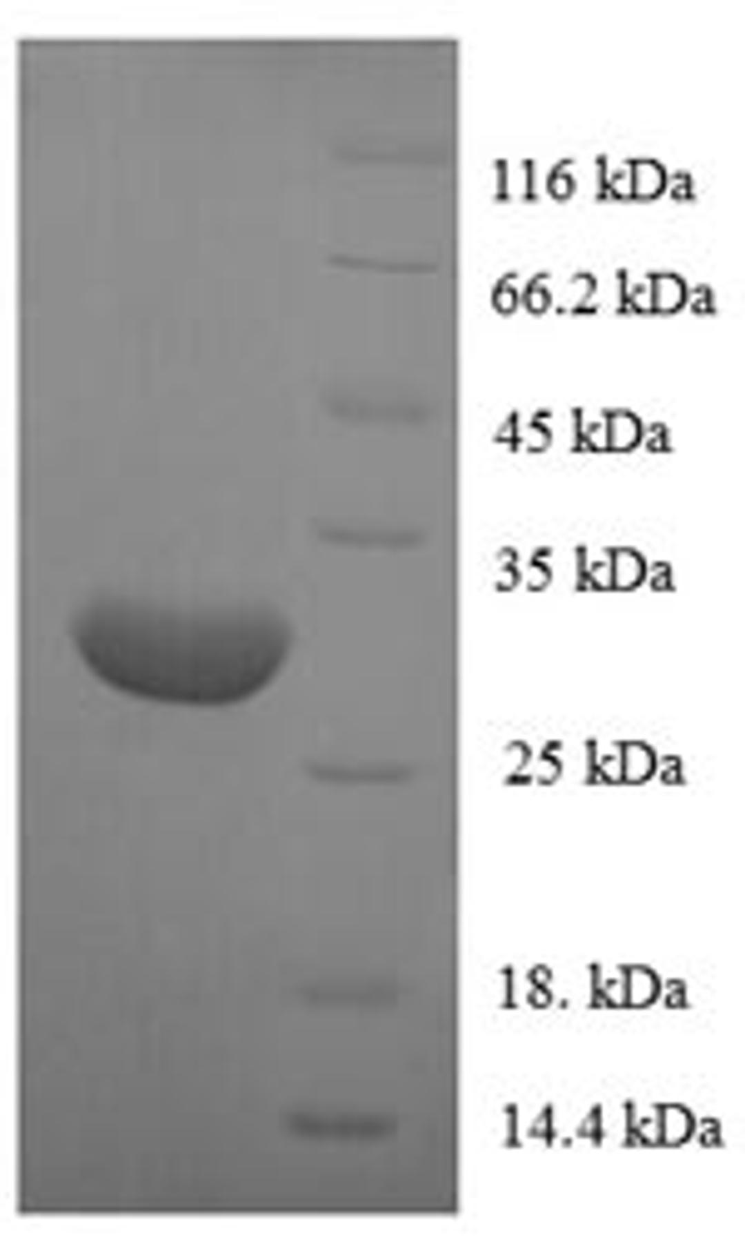 (Tris-Glycine gel) Discontinuous SDS-PAGE (reduced) with 5% enrichment gel and 15% separation gel.