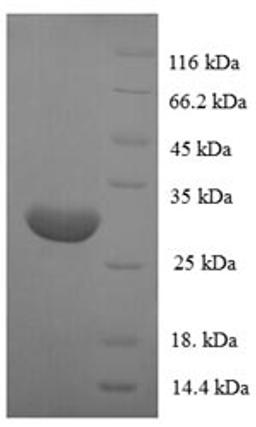 (Tris-Glycine gel) Discontinuous SDS-PAGE (reduced) with 5% enrichment gel and 15% separation gel.