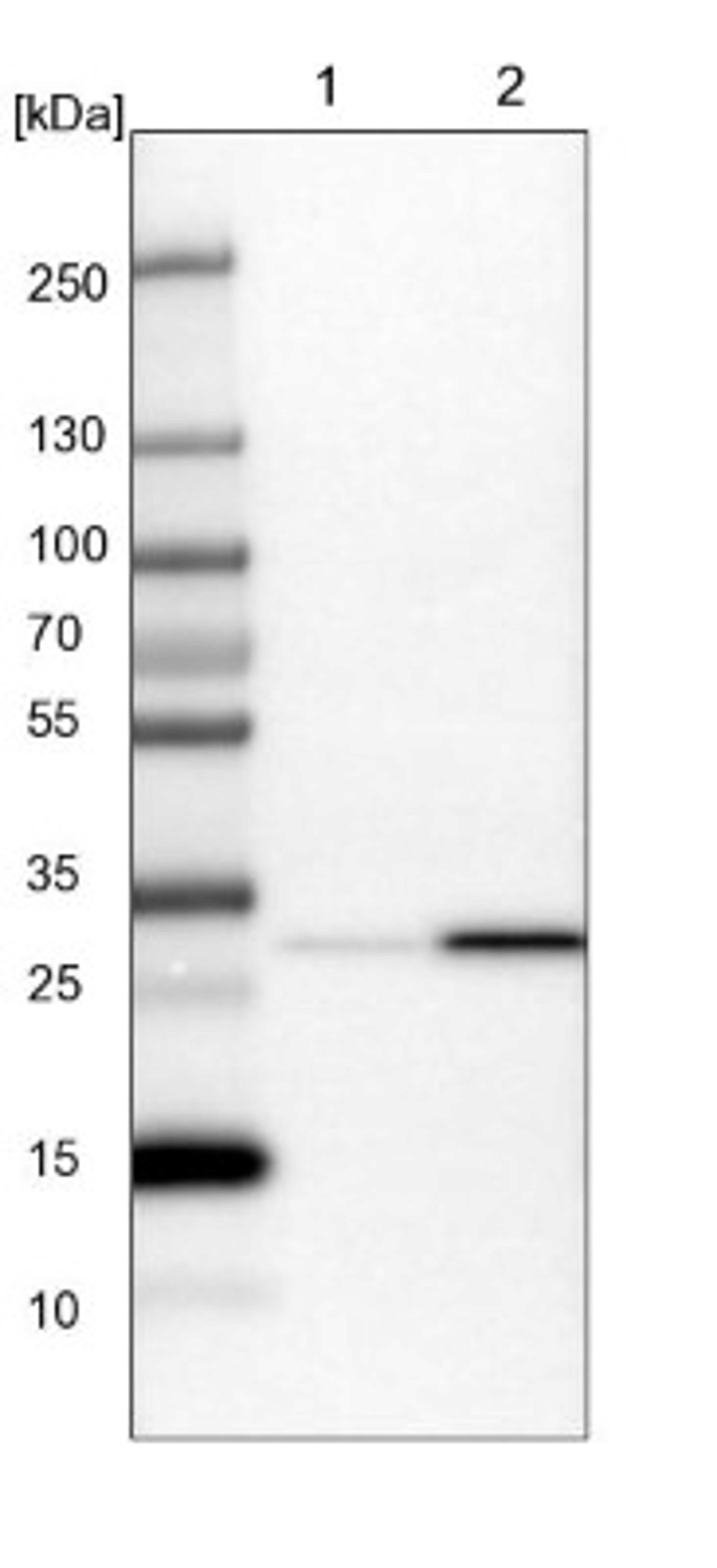 Western Blot: GLOD4 Antibody [NBP1-88462] - Lane 1: NIH-3T3 cell lysate (Mouse embryonic fibroblast cells)<br/>Lane 2: NBT-II cell lysate (Rat Wistar bladder tumour cells)