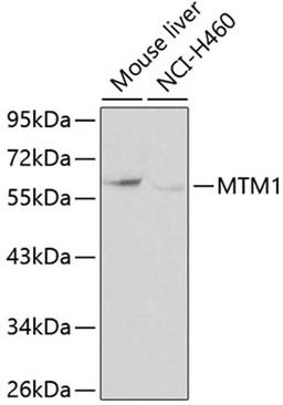 Western blot - MTM1 antibody (A0255)