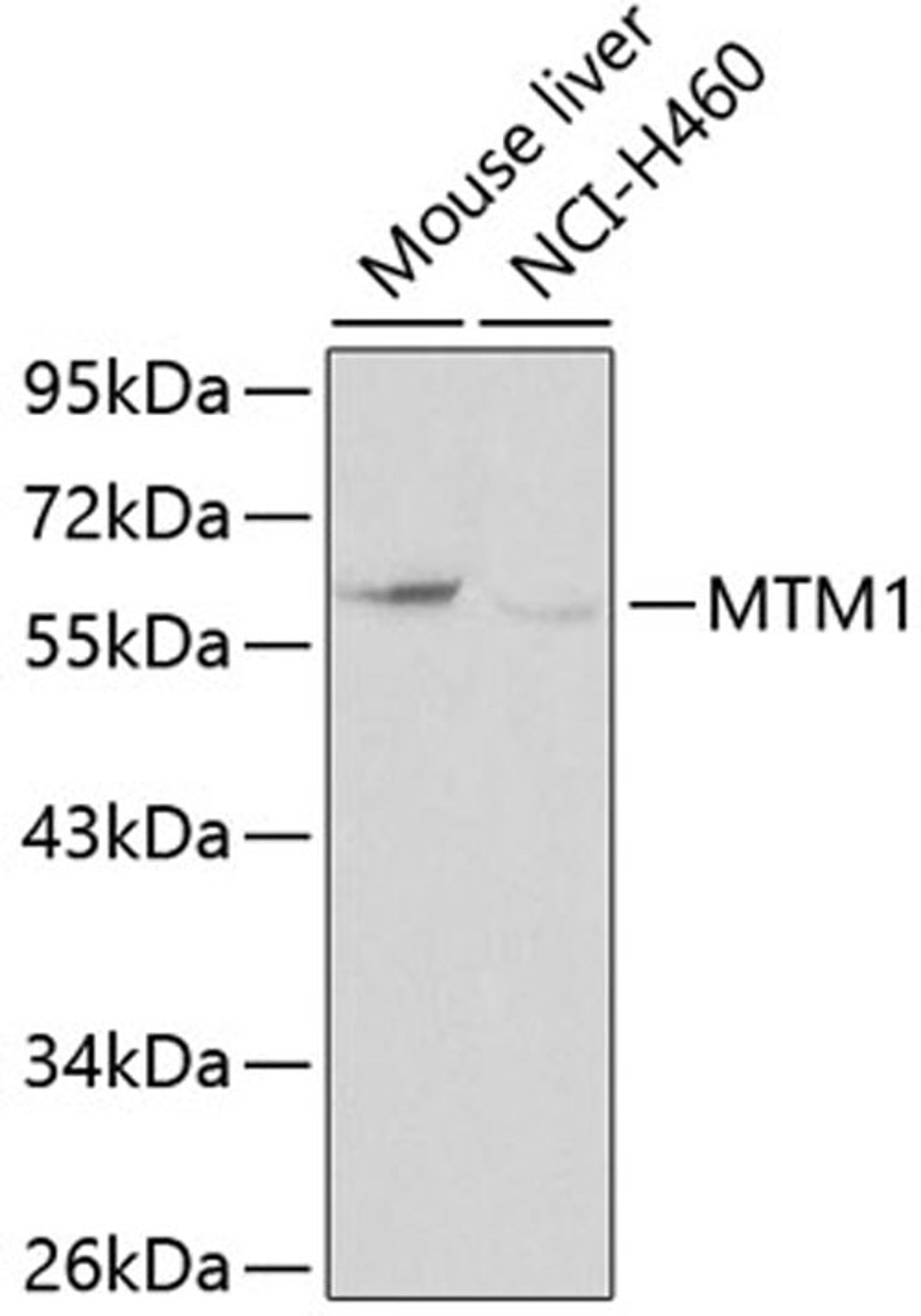 Western blot - MTM1 antibody (A0255)