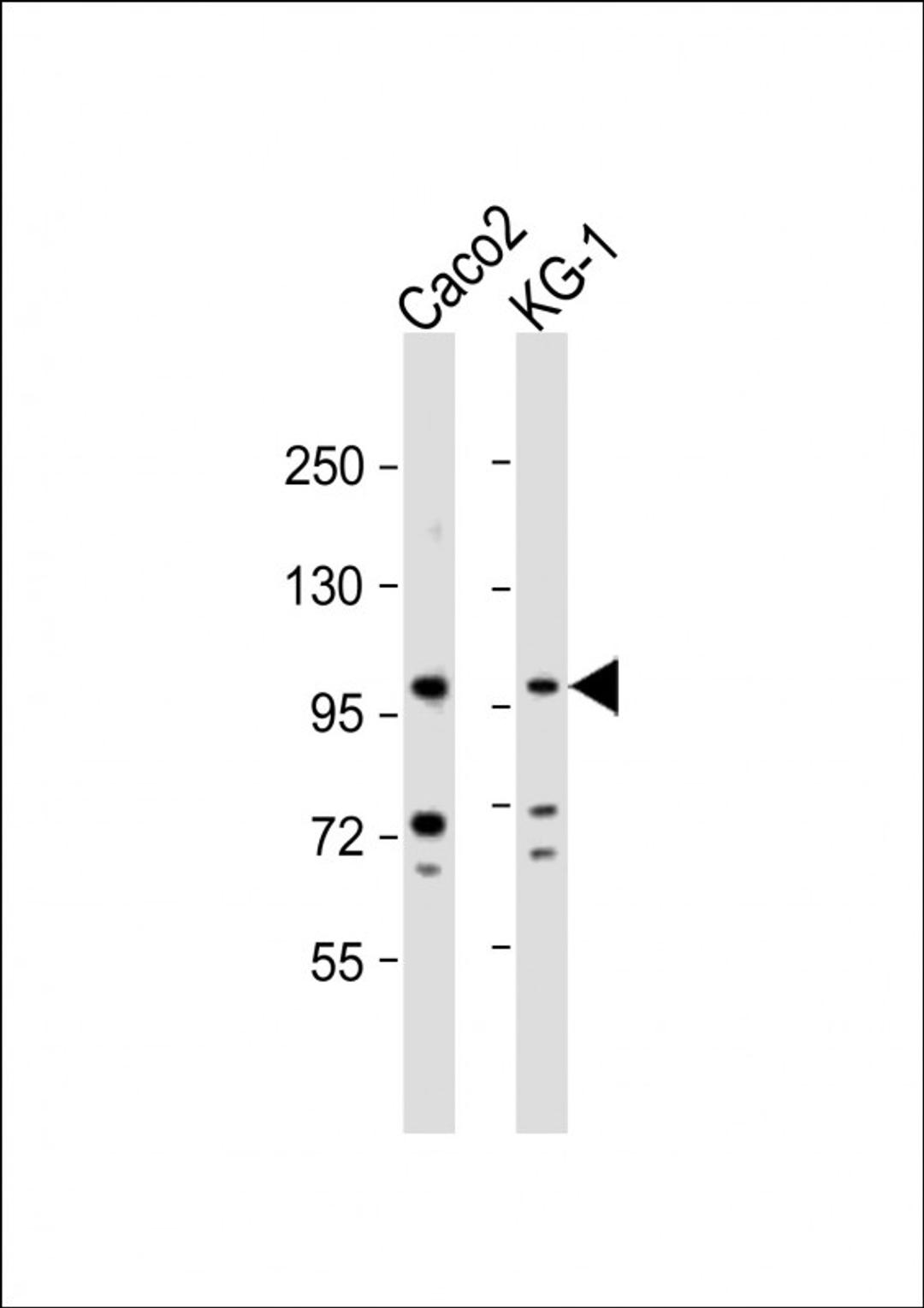 Western Blot at 1:1000 dilution Lane 1: Caco2 whole cell lysate Lane 2: KG-1 whole cell lysate Lysates/proteins at 20 ug per lane.