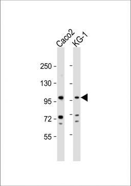 Western Blot at 1:1000 dilution Lane 1: Caco2 whole cell lysate Lane 2: KG-1 whole cell lysate Lysates/proteins at 20 ug per lane.