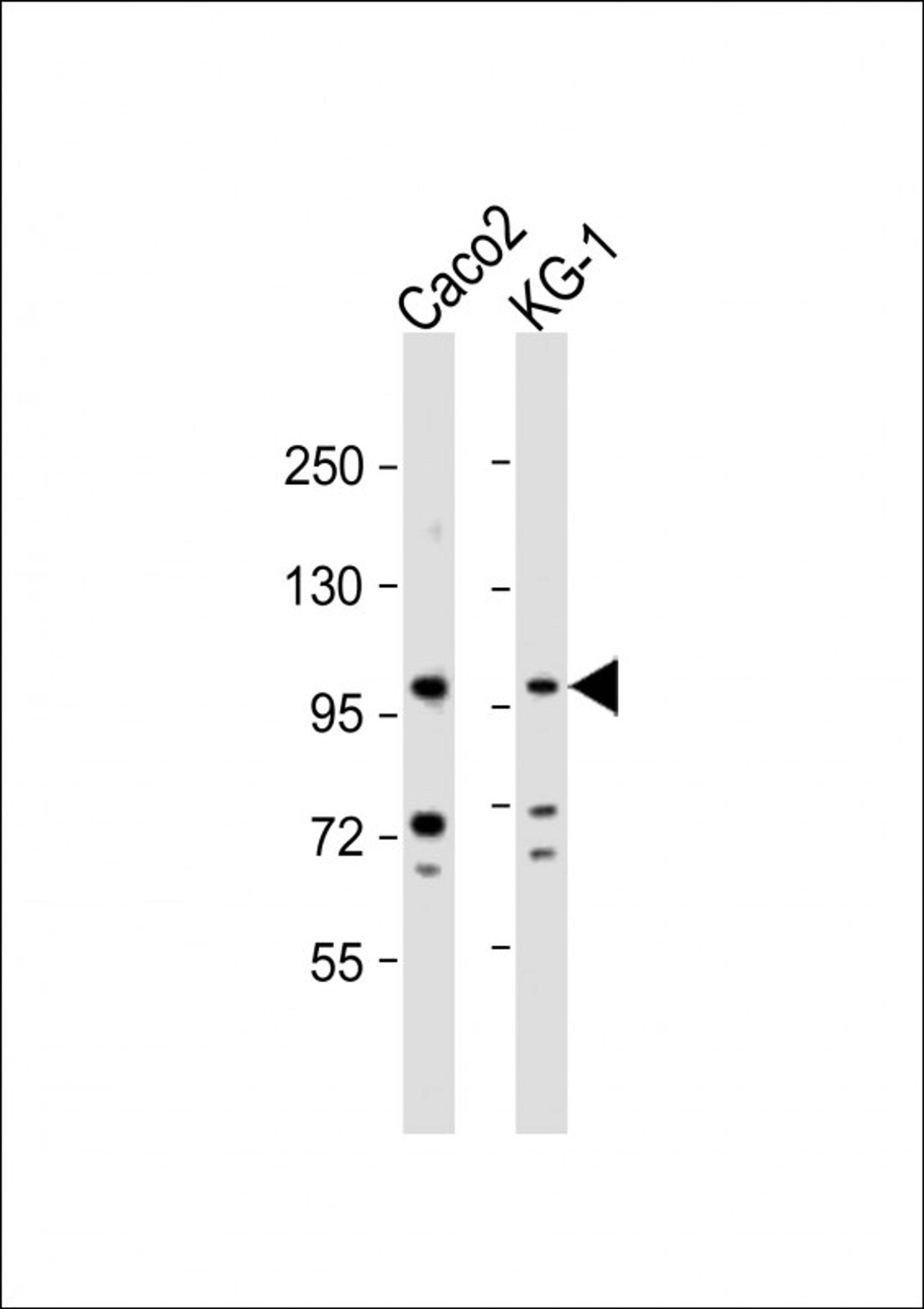 Western Blot at 1:1000 dilution Lane 1: Caco2 whole cell lysate Lane 2: KG-1 whole cell lysate Lysates/proteins at 20 ug per lane.