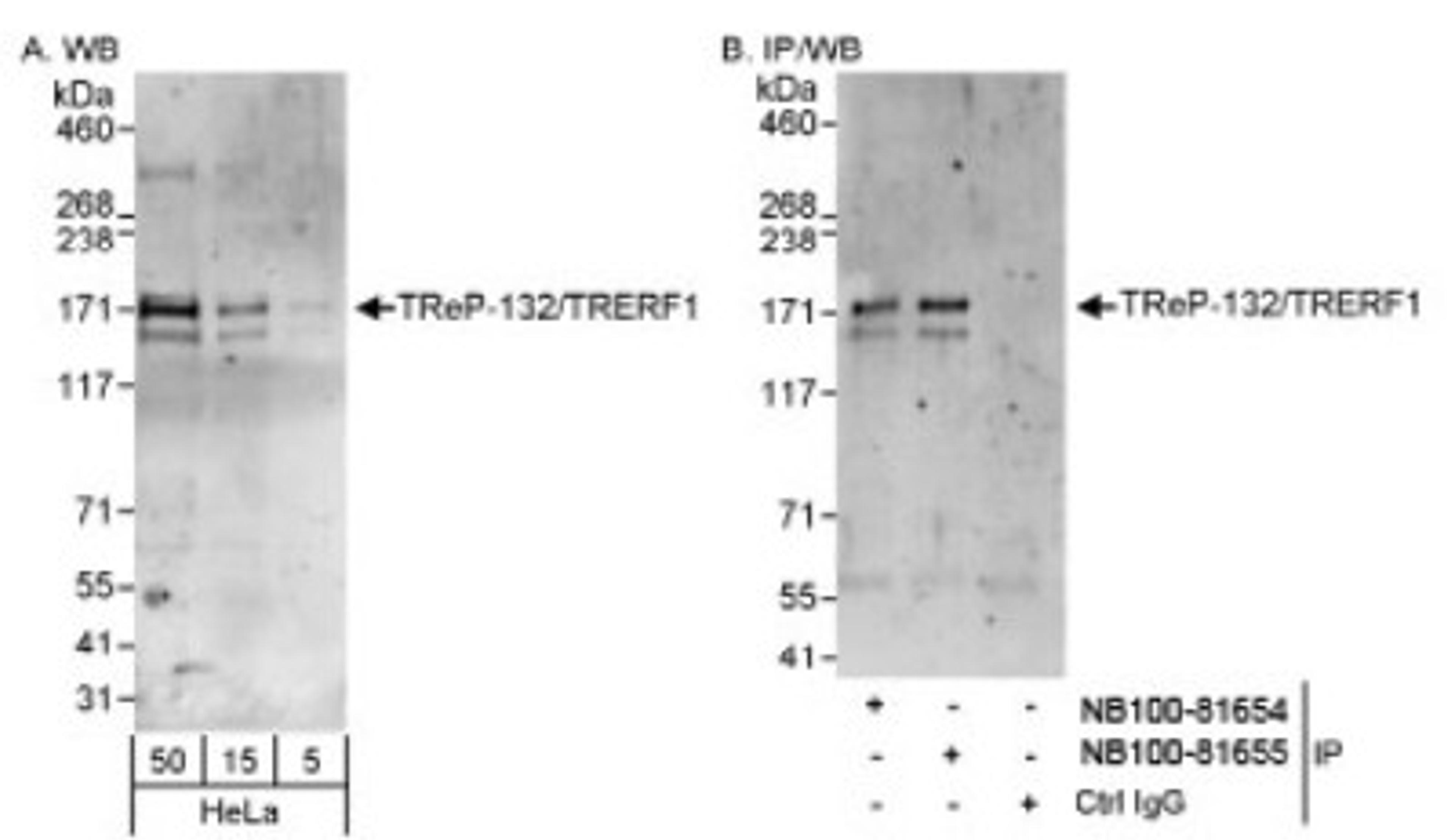 Western Blot: TRERF1 Antibody [NB100-81655] - Detection of Human TReP-132/TRERF1 on HeLa whole cell lysate using NB100-81655. TReP-132/TRERF1 was also immunoprecipitated by rabbit anti-TReP-132/TRERF1 antibody NB100-81654.