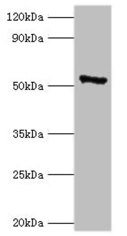 Western blot. All lanes: CAMK4 antibody at 2µg/ml + 293T whole cell lysate. Secondary. Goat polyclonal to rabbit IgG at 1/10000 dilution. Predicted band size: 52 kDa. Observed band size: 52 kDa